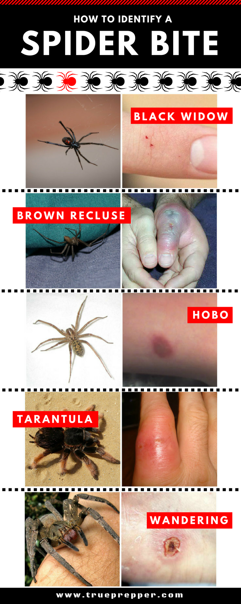 How to Identify a Spider Bite Infographic